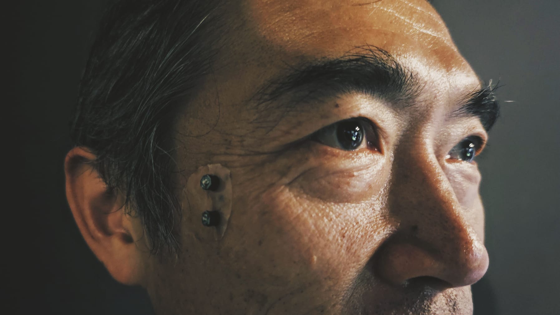 placing LED on cheekbone